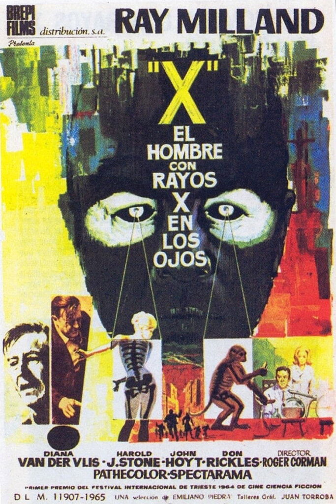 El hombre de los Rayos X en los ojos
